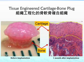 (左)骨髓間質幹細胞,連同生物材料,生長成一個組織工程骨軟骨複合組織。(右)在動物的膝關節軟骨損傷移植後一個月,再生的具有適當結構組織的透明軟骨,骨-軟骨界面和底層骨組織。